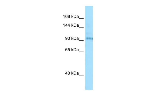 BBS9 Antibody in Western Blot (WB)