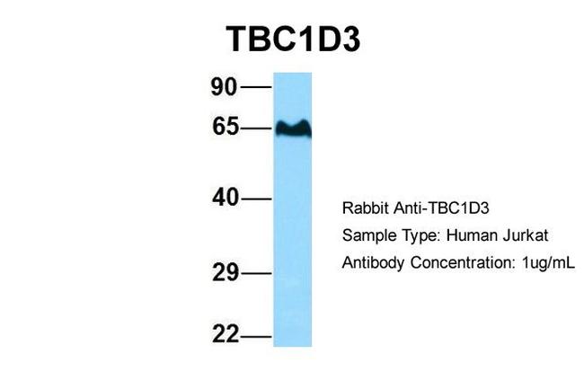 TBC1D3 Antibody in Western Blot (WB)