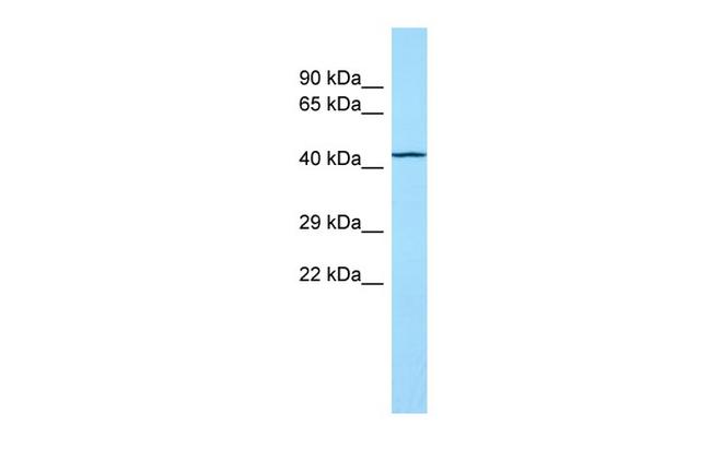TOR1AIP2 Antibody in Western Blot (WB)