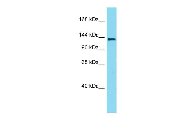 LMTK3 Antibody in Western Blot (WB)