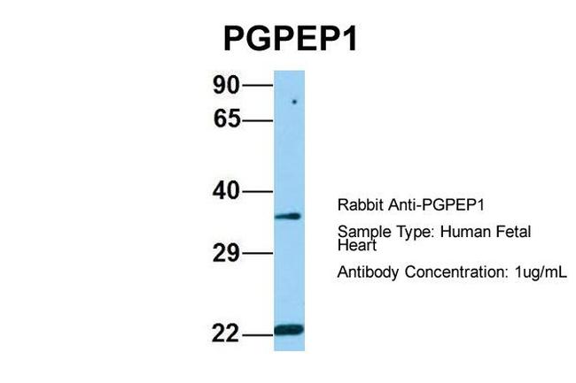 PGPEP1 Antibody in Western Blot (WB)