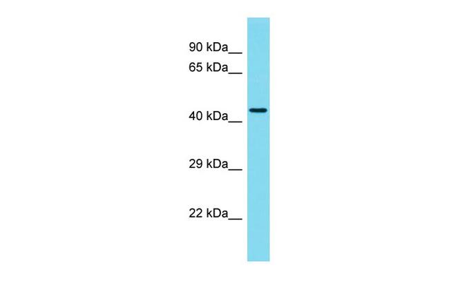 C6orf163 Antibody in Western Blot (WB)