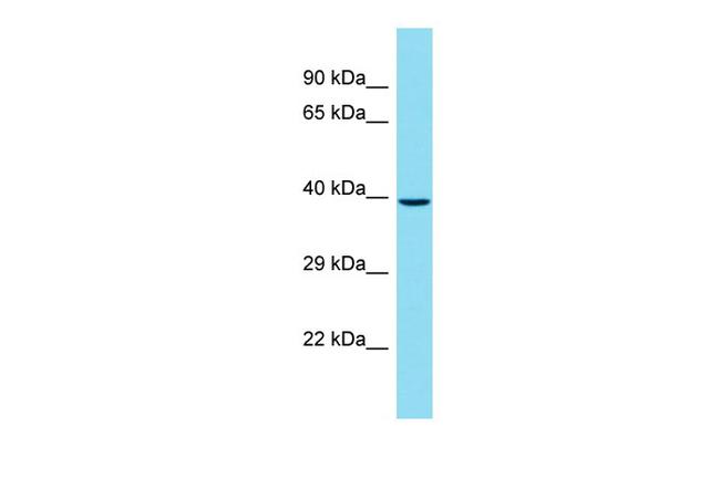 CENPL Antibody in Western Blot (WB)