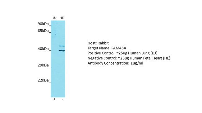 FAM45A Antibody in Western Blot (WB)
