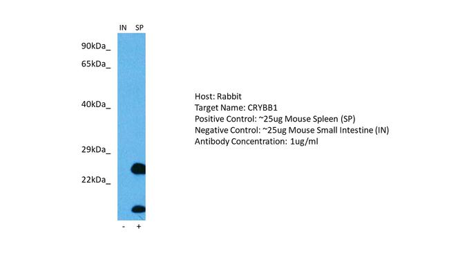 CRYBB1 Antibody in Western Blot (WB)