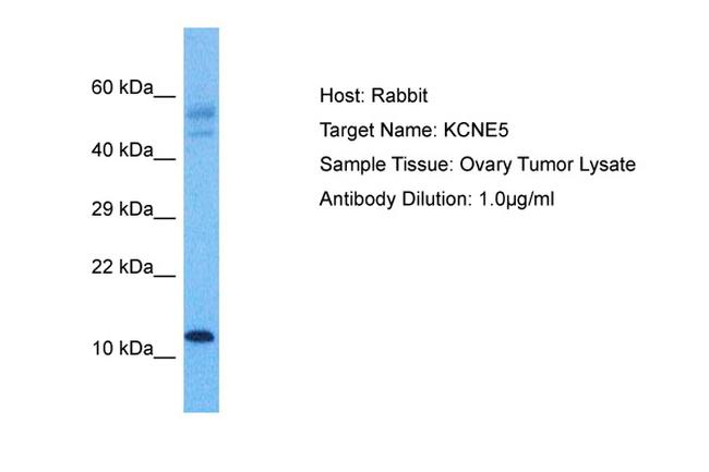 KCNE1L Antibody in Western Blot (WB)