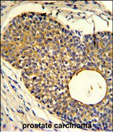 APOBEC3A Antibody in Immunohistochemistry (Paraffin) (IHC (P))
