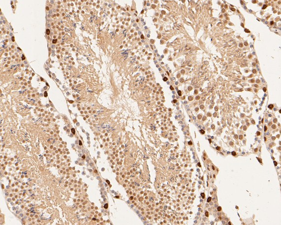 DUX4 Antibody in Immunohistochemistry (Paraffin) (IHC (P))
