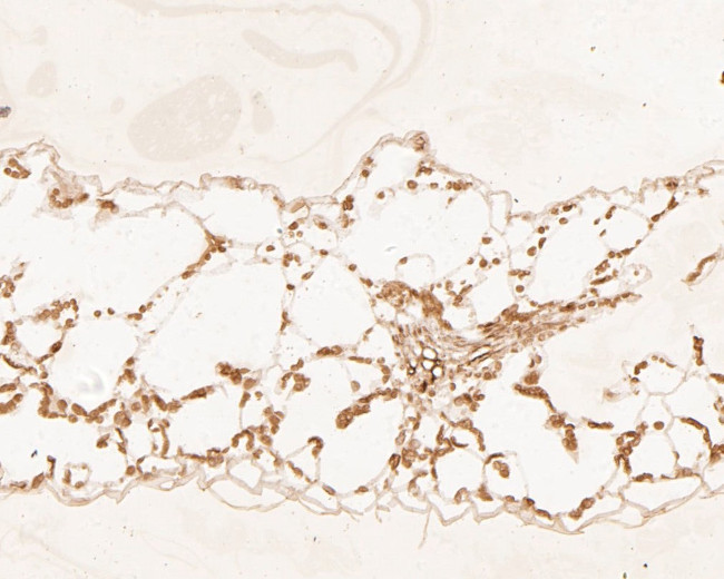HDG11 Antibody in Immunohistochemistry (Paraffin) (IHC (P))