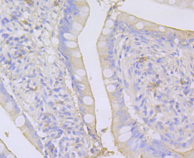 SPATA5L1 Antibody in Immunohistochemistry (Paraffin) (IHC (P))