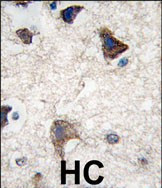 CDH4 Antibody in Immunohistochemistry (Paraffin) (IHC (P))