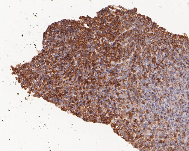 C19orf63 Antibody in Immunohistochemistry (Paraffin) (IHC (P))