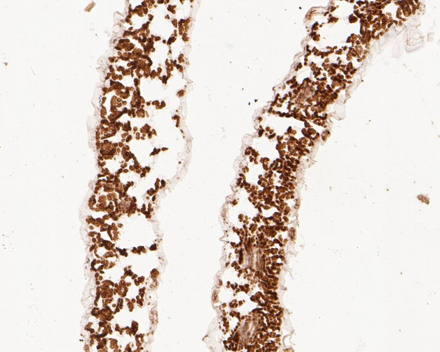 Beta-adaptin-like protein A Antibody in Immunohistochemistry (Paraffin) (IHC (P))