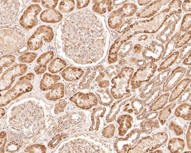 GSDMC Antibody in Immunohistochemistry (Paraffin) (IHC (P))