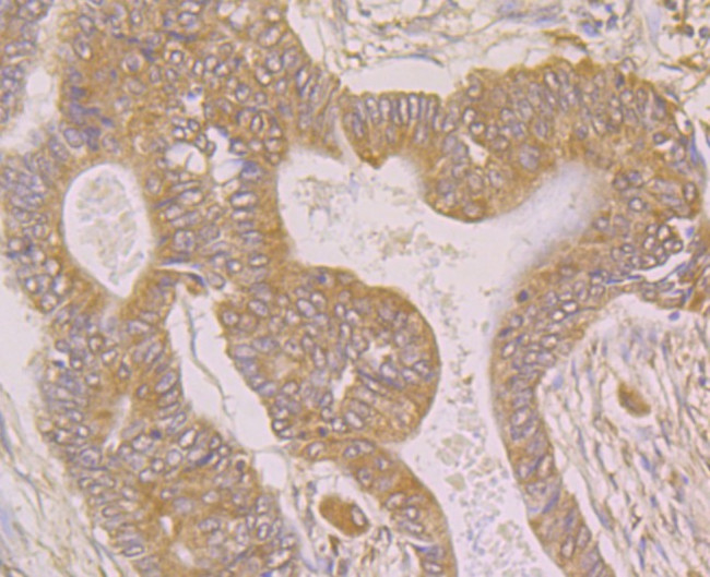SPATA13 Antibody in Immunohistochemistry (Paraffin) (IHC (P))