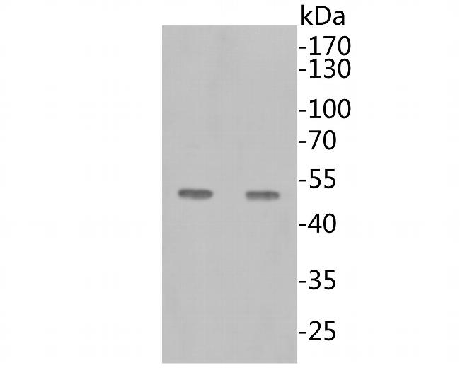 SARS-CoV-2 Nucleocapsid Antibody in Western Blot (WB)