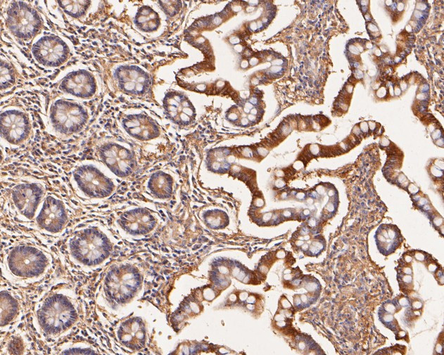 SLFN12 Antibody in Immunohistochemistry (Paraffin) (IHC (P))
