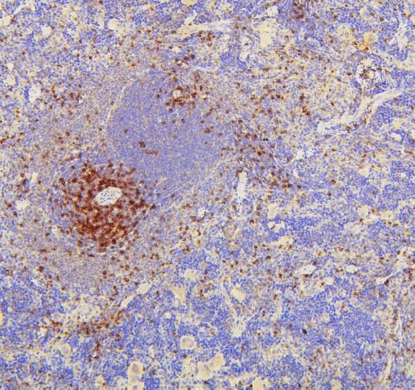 Cd8a Antibody in Immunohistochemistry (Paraffin) (IHC (P))