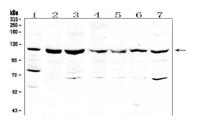 HOIP Antibody in Western Blot (WB)