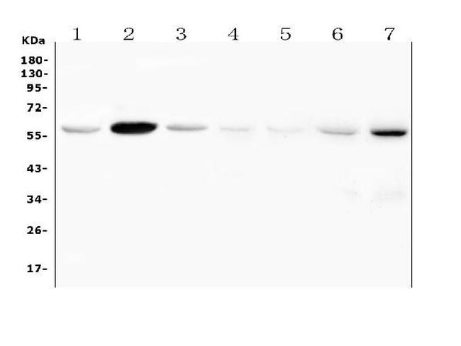 FSCN2 Antibody in Western Blot (WB)