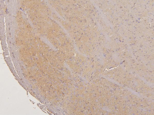 LMTK3 Antibody in Immunohistochemistry (Paraffin) (IHC (P))