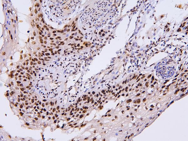 PHF21A Antibody in Immunohistochemistry (Paraffin) (IHC (P))