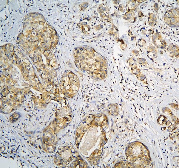 CPAMD8 Antibody in Immunohistochemistry (Paraffin) (IHC (P))