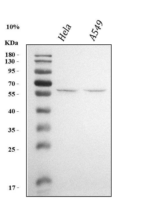 KLF5 Antibody in Western Blot (WB)