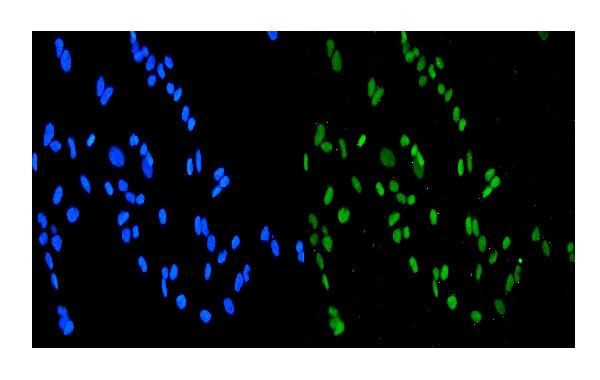 SMURF1 Antibody in Immunocytochemistry (ICC/IF)