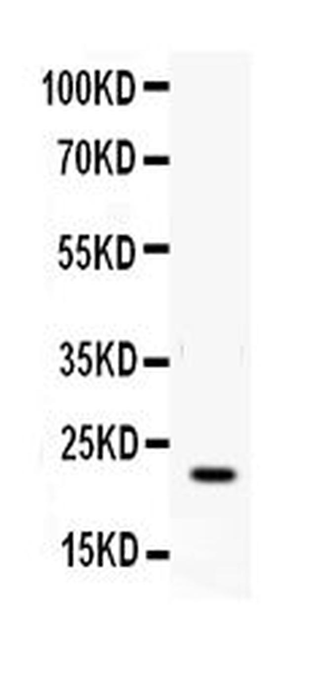 IFN gamma Antibody in Western Blot (WB)