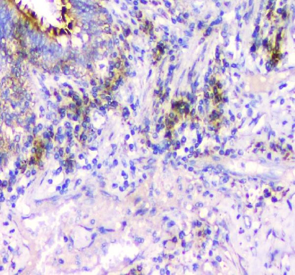 IFN gamma Antibody in Immunohistochemistry (Paraffin) (IHC (P))