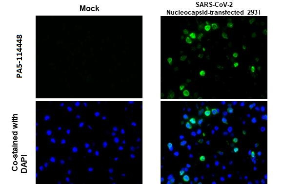 SARS-CoV-2 Nucleocapsid Antibody in Immunocytochemistry (ICC/IF)