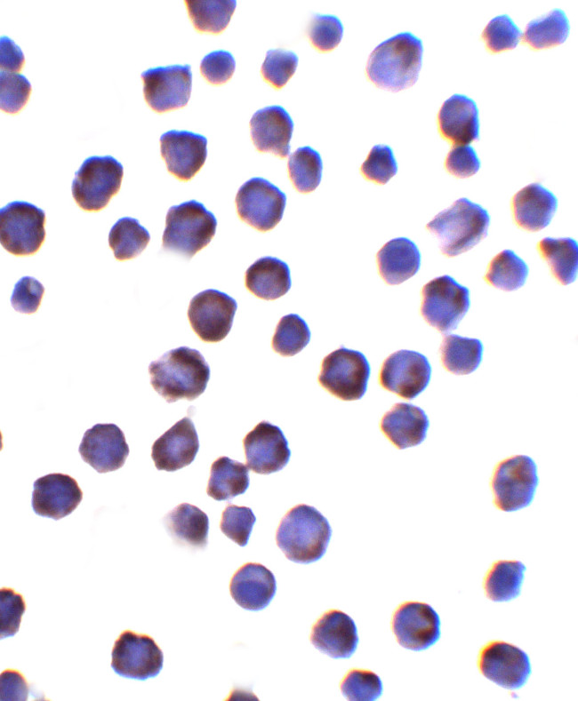 FOXD4L1 Antibody in Immunocytochemistry (ICC/IF)