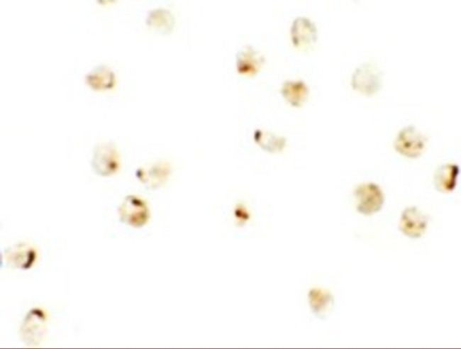 IRF2BP2 Antibody in Immunocytochemistry (ICC/IF)