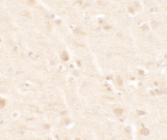 beta-2 Microglobulin Antibody in Immunohistochemistry (Paraffin) (IHC (P))