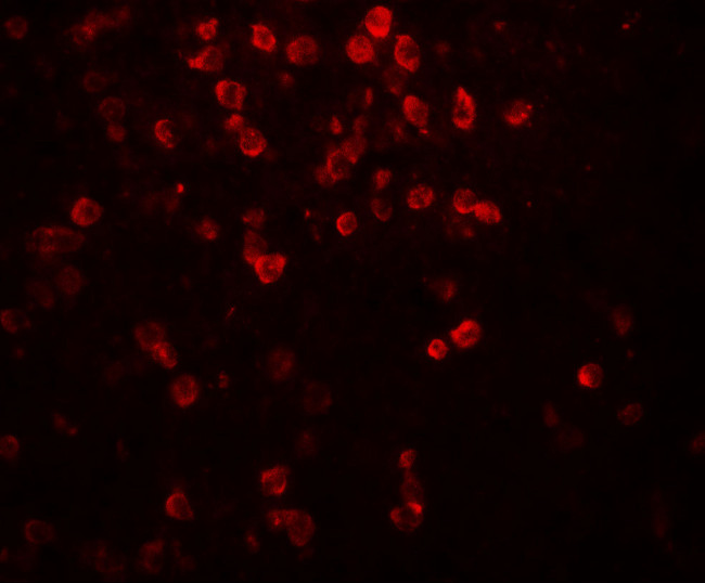 IL-9 Antibody in Immunohistochemistry (Paraffin) (IHC (P))