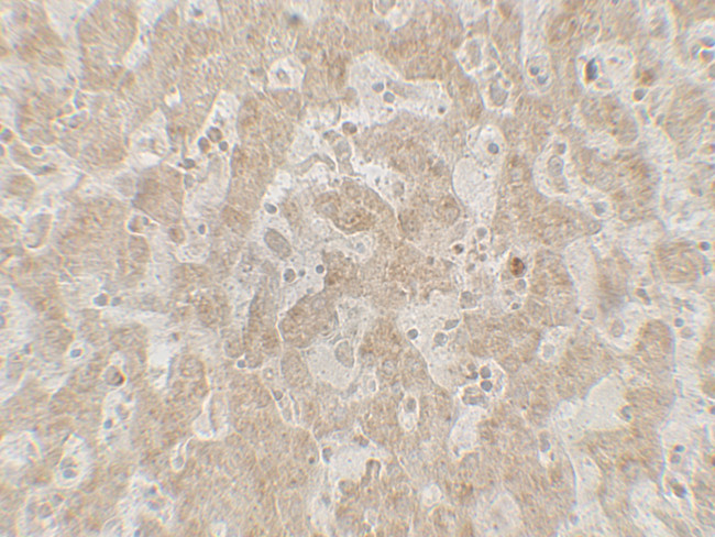 CCR7 Antibody in Immunohistochemistry (Paraffin) (IHC (P))