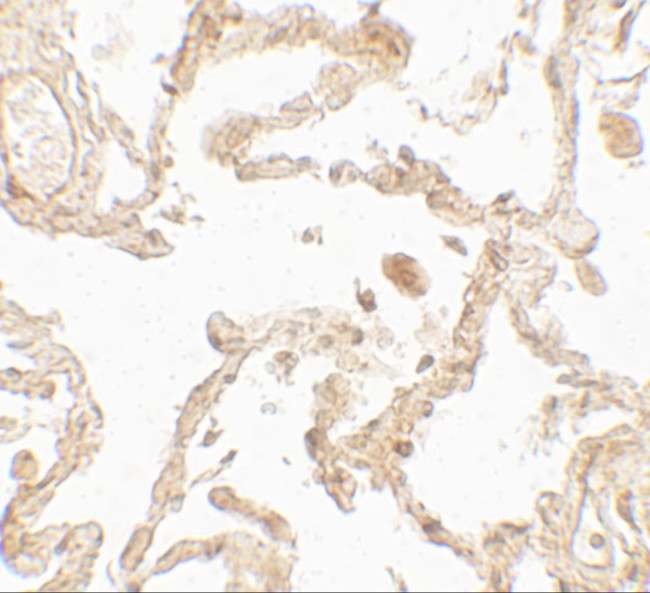 SUZ12 Antibody in Immunohistochemistry (Paraffin) (IHC (P))
