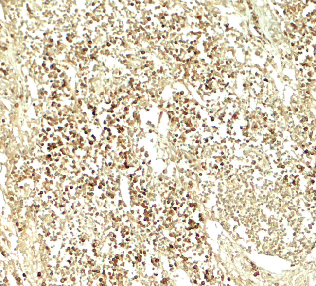 E2F3 Antibody in Immunohistochemistry (Paraffin) (IHC (P))