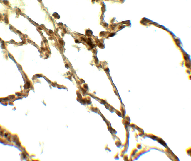 CD55 Antibody in Immunohistochemistry (Paraffin) (IHC (P))