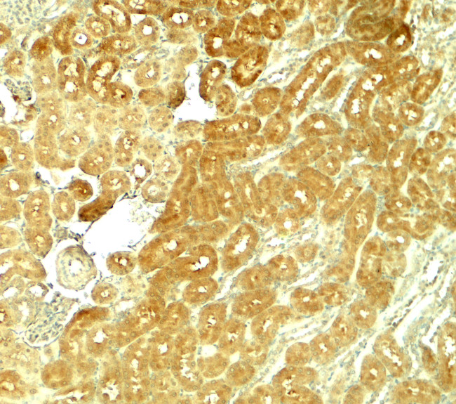 SMURF1 Antibody in Immunohistochemistry (Paraffin) (IHC (P))