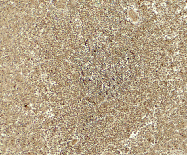 ATG4B Antibody in Immunohistochemistry (Paraffin) (IHC (P))