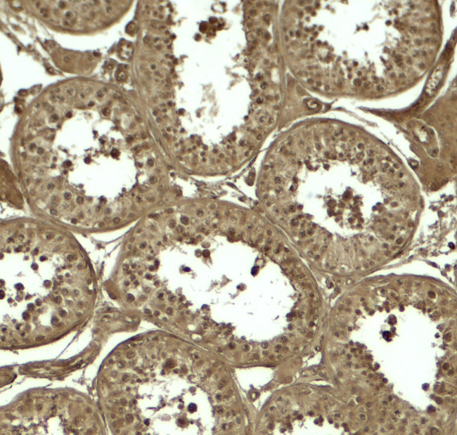 ATG4D Antibody in Immunohistochemistry (Paraffin) (IHC (P))