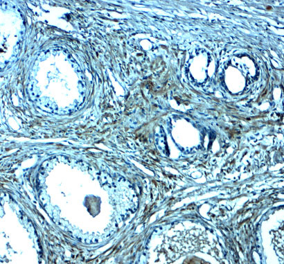 SPIB Antibody in Immunohistochemistry (Paraffin) (IHC (P))