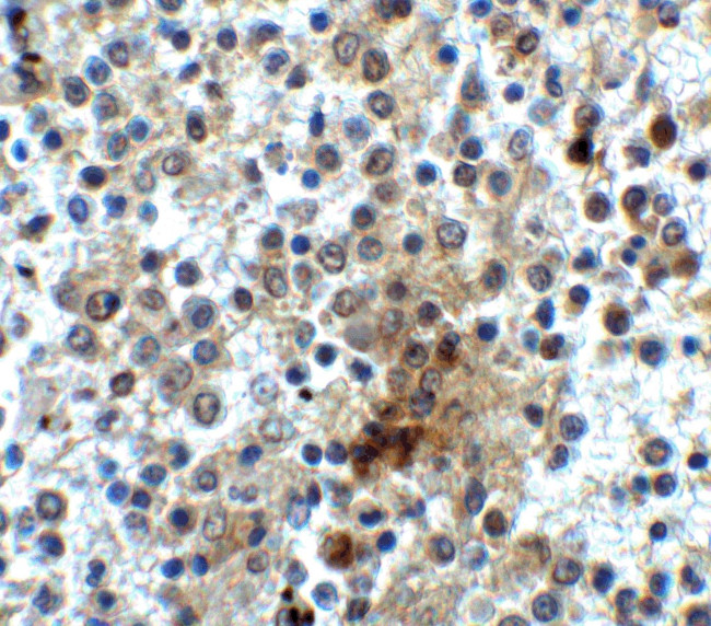 CD28 Antibody in Immunohistochemistry (IHC)