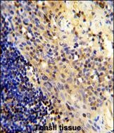 CD8 alpha Antibody in Immunohistochemistry (Paraffin) (IHC (P))
