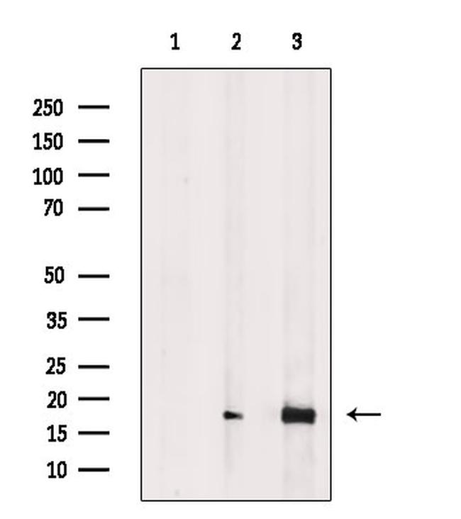 Phospho-4EBP1 (Thr37, Thr46) Antibody in Western Blot (WB)