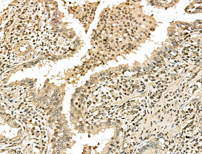 Phospho-53BP1 (Ser25, Ser29) Antibody in Immunohistochemistry (Paraffin) (IHC (P))