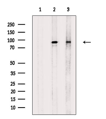 Phospho-beta Catenin (Ser552) Antibody in Western Blot (WB)