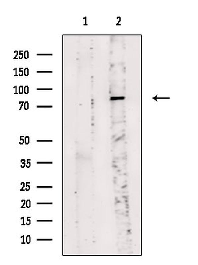 Phospho-beta Catenin (Tyr333) Antibody in Western Blot (WB)